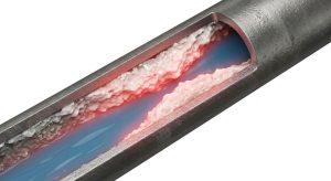 pipe clogged with impurities